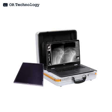 Hệ thống X-Quang kỹ thuật số xách tay - Leonardo DR mini II